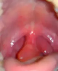 mouth.webp