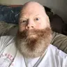 Irish44